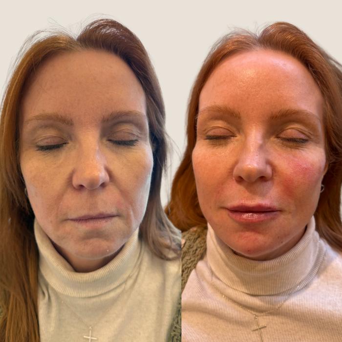 “I Feel Like My Face Has Suddenly Aged” – Where Do You Start With Aesthetic Treatments?