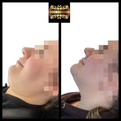 Literally Jaw Dropping Lemon Bottle Results