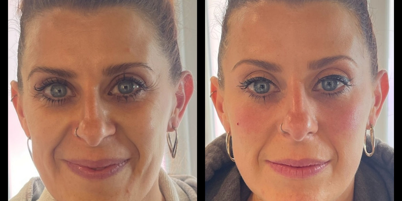Personalised Anti Aging Packages