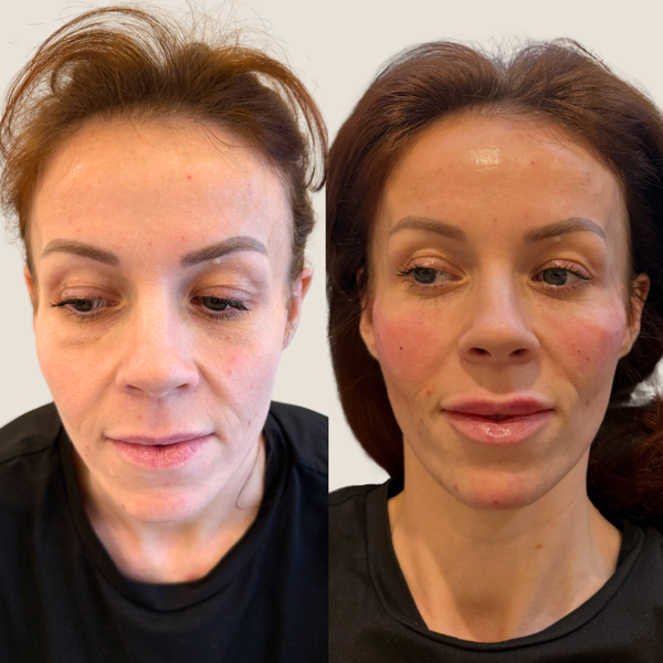 Before and after result